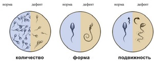 Сравнительная характеристика нормальных и патологических сперматозоидов