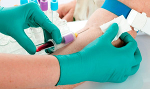 Лабораторная диагностика - анализ крови на количество гормонов