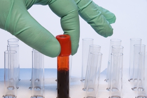 Биохимический анализ крови - что проверяет?