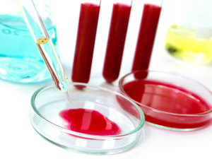 Какие болезни помогает диагностировать анализ крови на биохимию